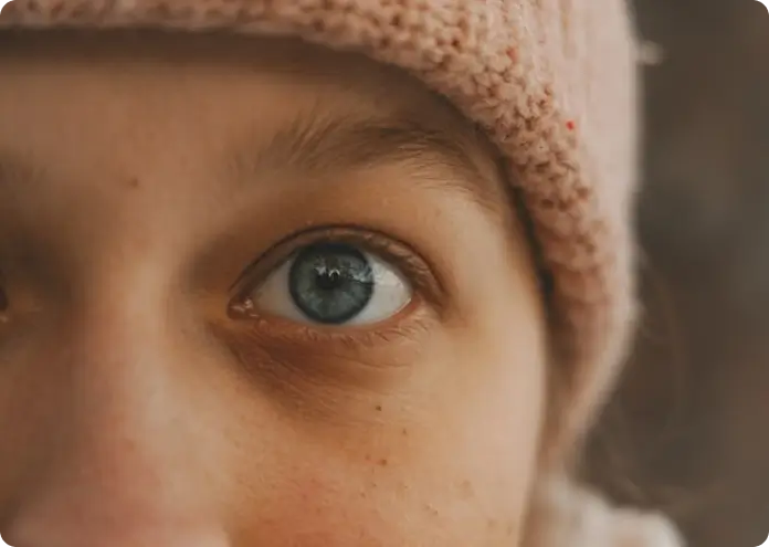 Who Needs PTSD Treatment?